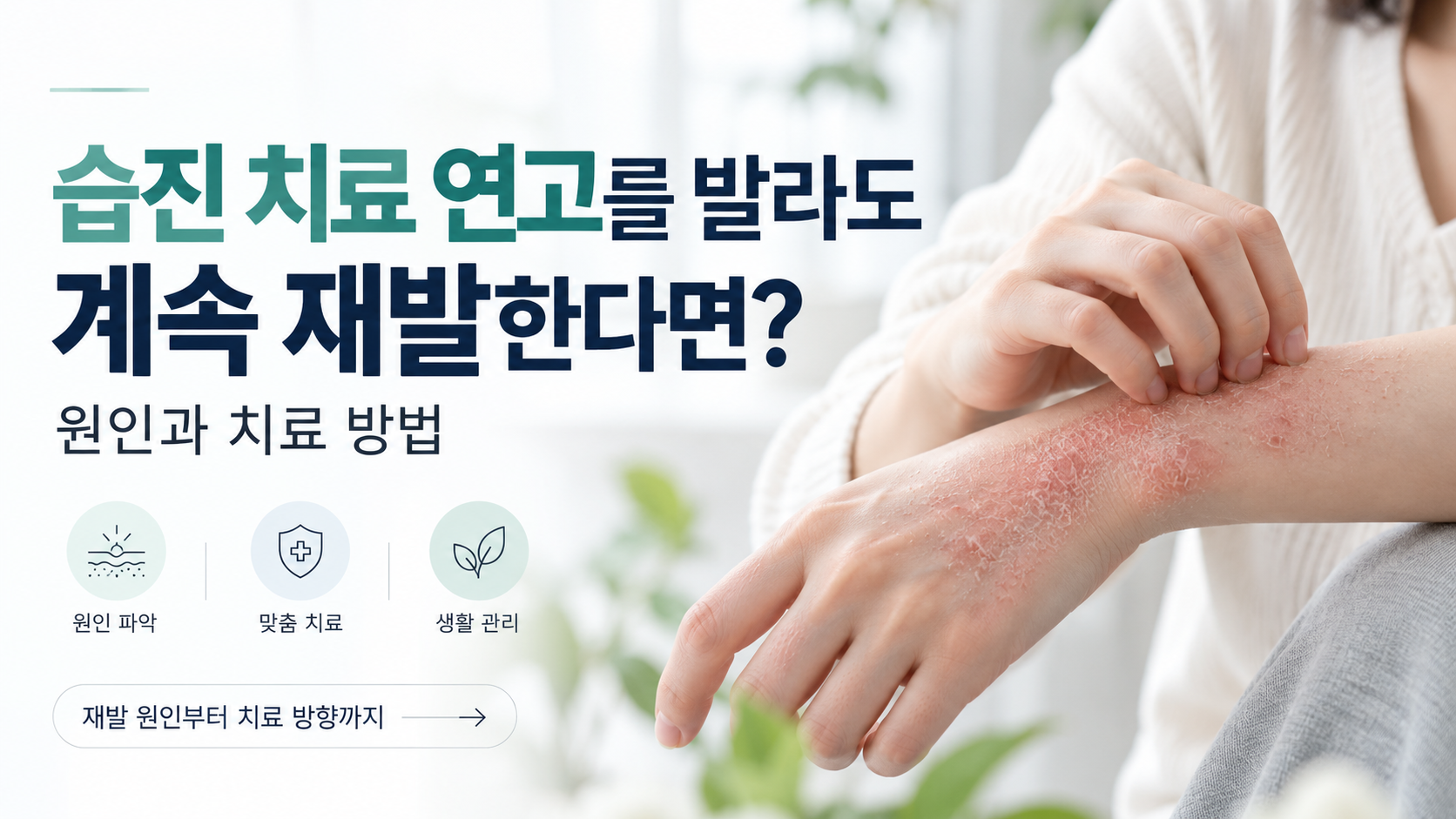 습진 연고를 발라도 피부가 붉고 가려운 증상이 반복되는 상황과 치료 방법