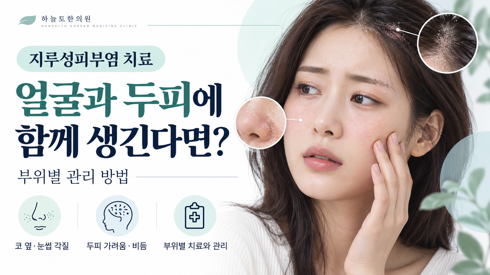 얼굴과 두피에 함께 발생한 지루성피부염의 증상과 부위별 관리 방법