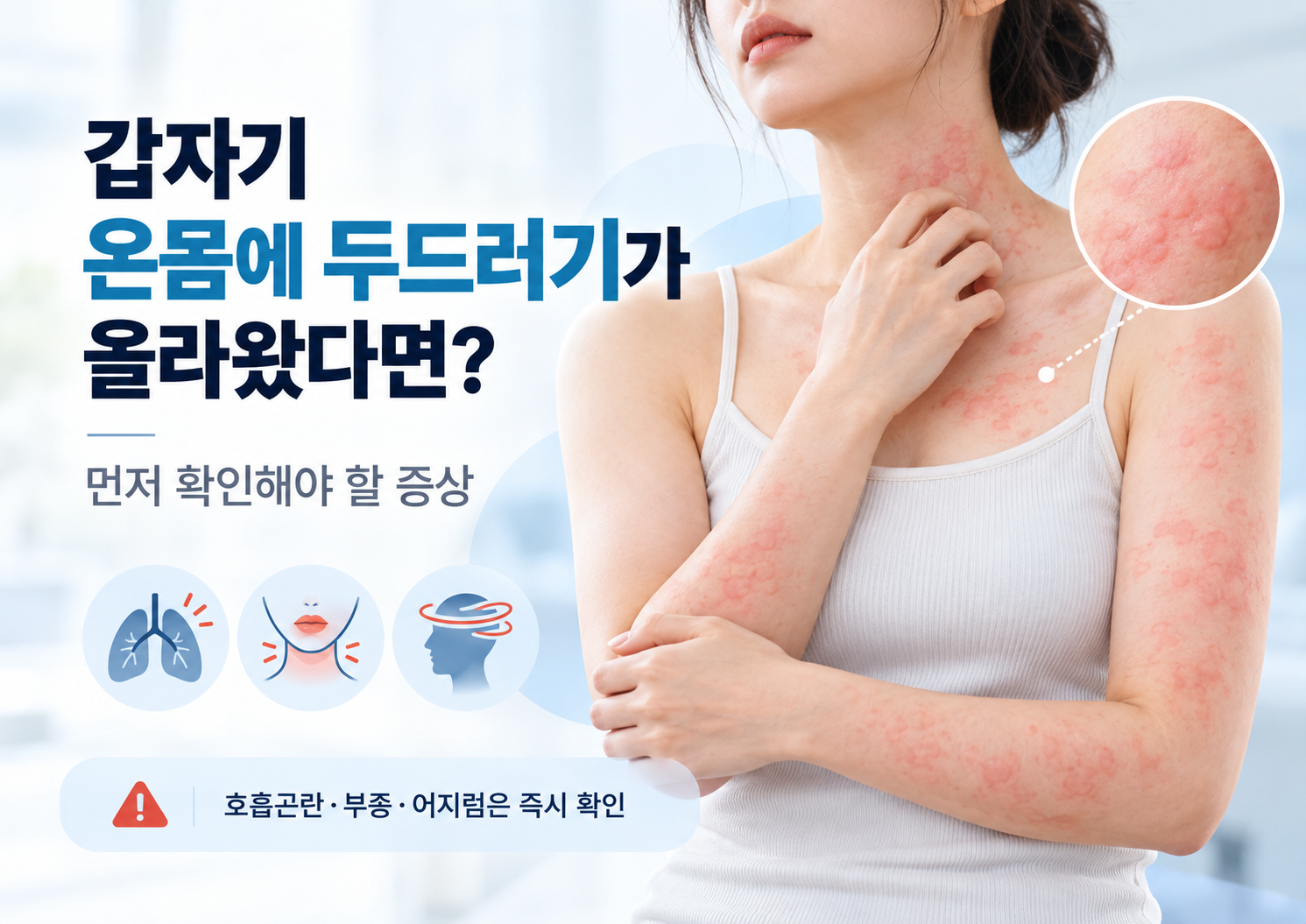 두드러기 초기증상 갑자기 온몸에 두드러기가 올라왔다면? 먼저 확인해야 할 증상
